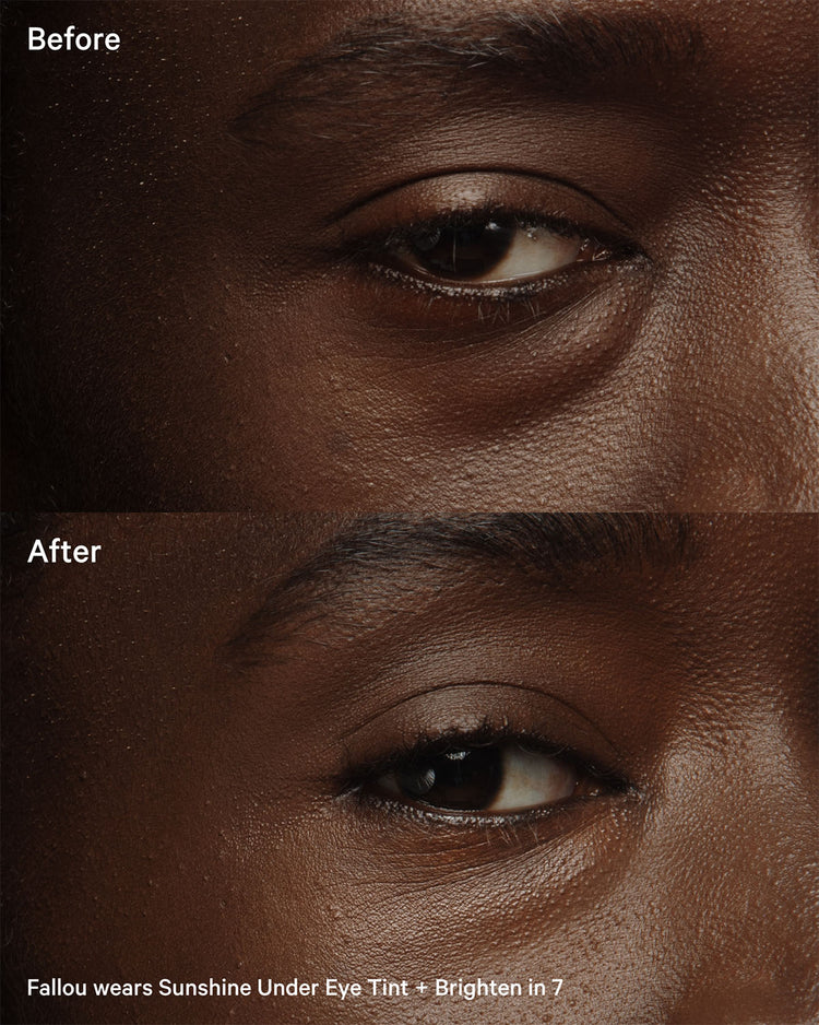 Sunshine-Under-Eye-Tint+Brighten-7-Before-After
